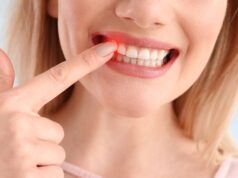 Як лікувати пародонтоз: комплексний підхід до збереження зубів